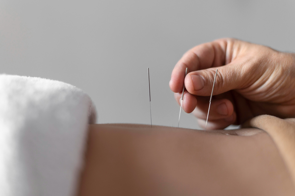Hormonal Balance Acupuncture Treatments in Northbrook, IL