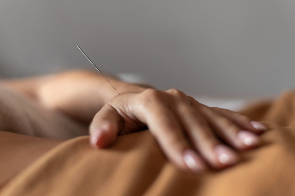 Menopause Acupuncture in Northbrook, IL: A Natural Solution for Hot Flashes & Hormonal Balance