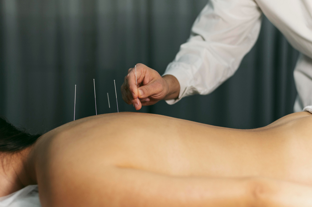 Fertility Acupuncture in Chicago: A Natural Approach to Boosting Conception