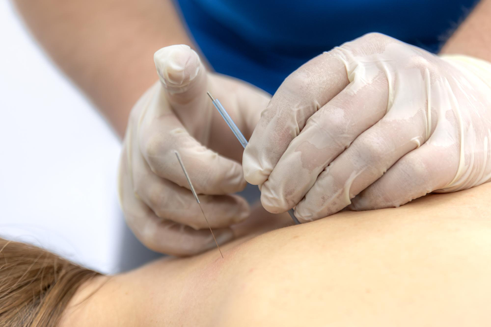 How Women’s Health Acupuncture Supports Hormonal Balance in Northbrook, IL