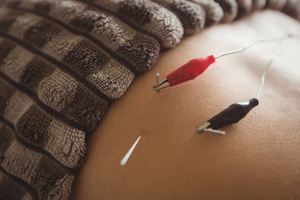 How Women’s Health Acupuncture Supports Hormonal Balance in Northbrook, IL
