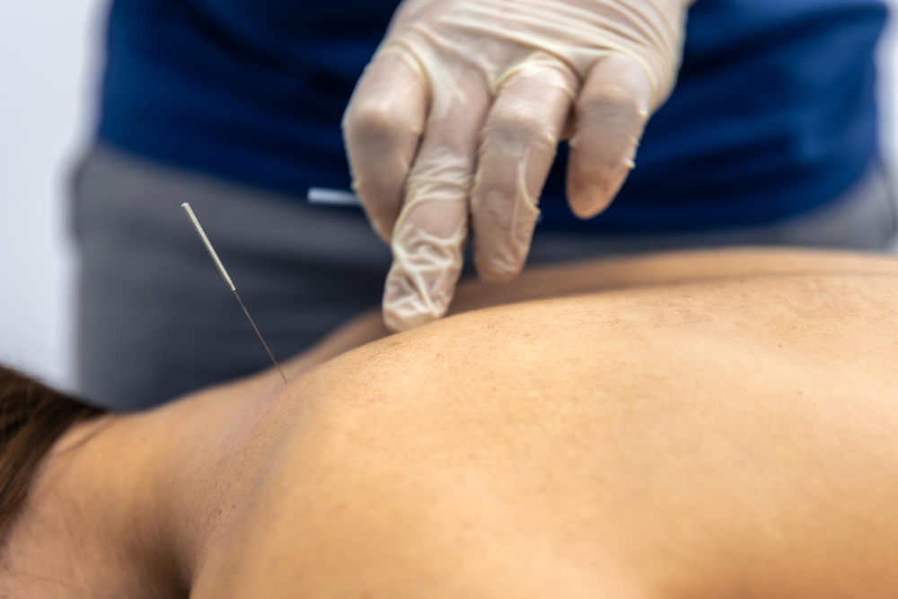 Postpartum Acupuncture in Northbrook, IL: How Can It Support Recovery?