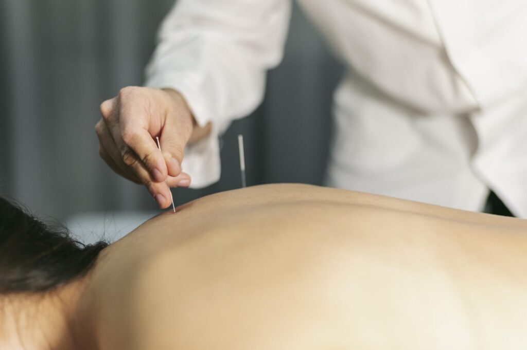 Fertility Acupuncture in Northbrook for Natural Conception | Acupuncture & Wellness Center Chicago